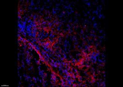 Melanoma Marker (MART-1 + Tyrosinase + gp100) Antibody (M2-7C10 + M2 ...